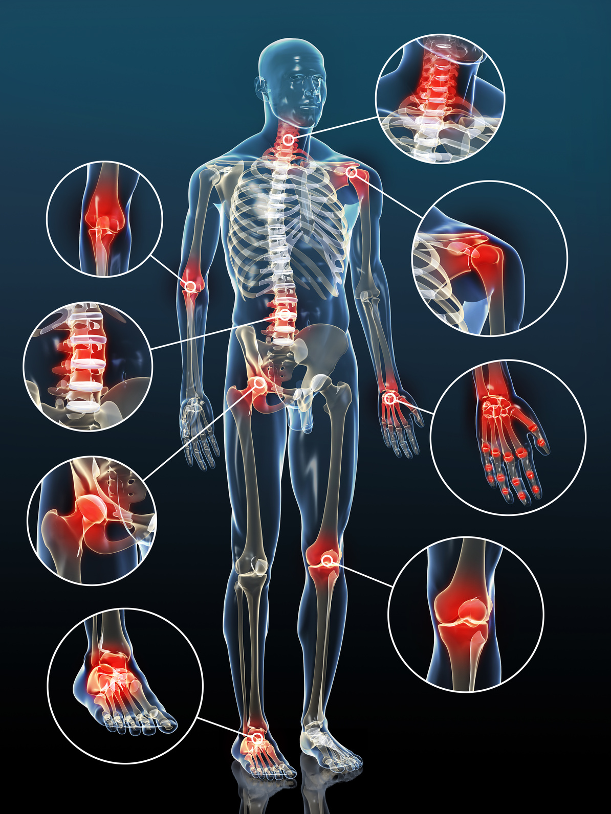 Traitement naturel Inflammations  Remèdes naturels Etats